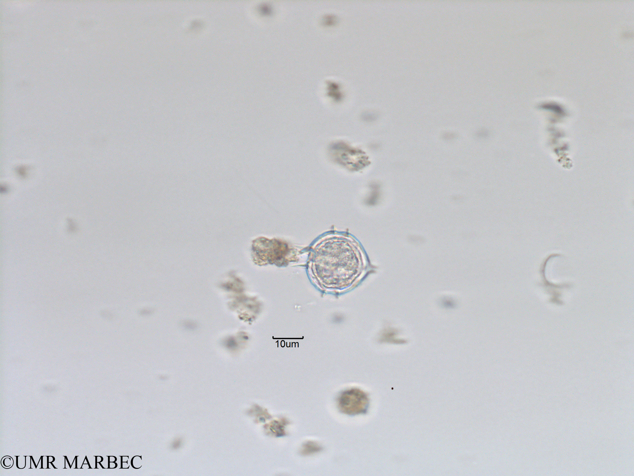 phyto/Bizerte/bizerte_lagoon/RISCO November 2015/Protoperidinium pellucidum (Lagune_T1_A_Proto sp19-2).tif(copy).jpg
